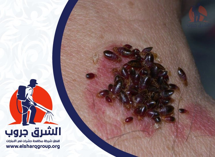 شركة مكافحة بق الفراش في الشارقة